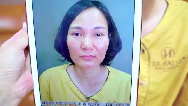 Mí hỏng ở cấp độ nào Dr.Hải Lê đều có thể giúp khách hàng chữa lành? Cùng theo dõi video Sửa mí DeepTech sau đây