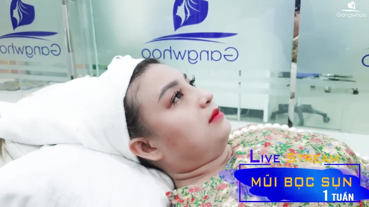 MŨI BỌC SỤN SAU 1 TUẦN THỰC HIỆN, KẾT QUẢ BẤT NGỜ…
