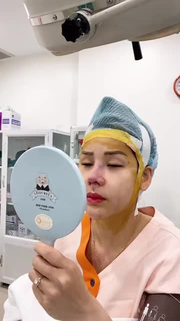 MŨI CẤU TRÚC DÁNG SLINE