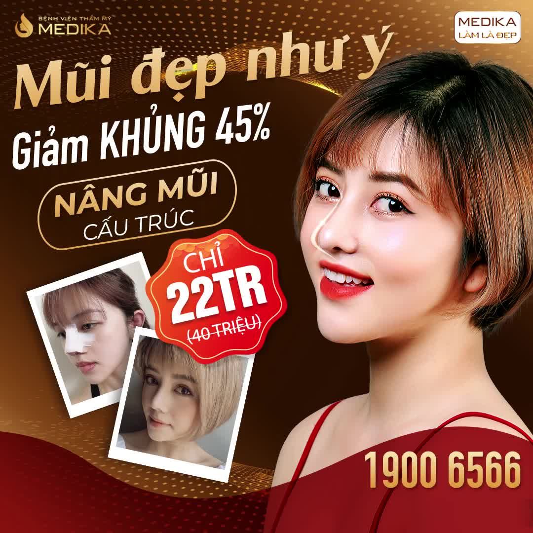 MŨI CẤU TRÚC LỰA CHỌN TUYỆT VỜI ĐỂ CHỈNH HÌNH MŨI TOÀN DIỆN