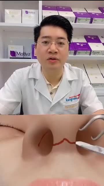 Mũi gồ, lệch vách ngăn do tai nạn?