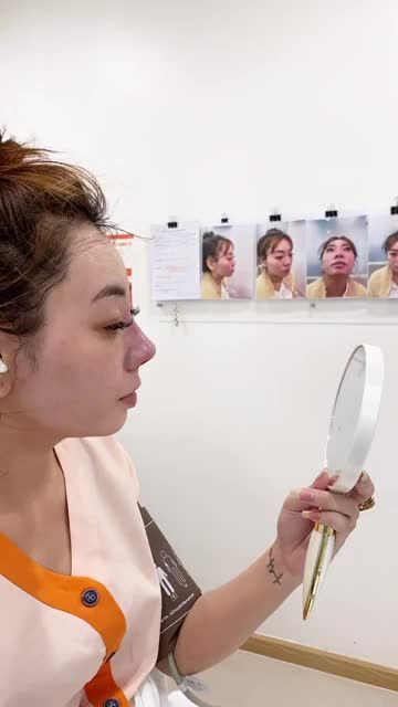 MŨI SLINE CAO CHO GƯƠNG MẶT THANH THOÁT HƠN
