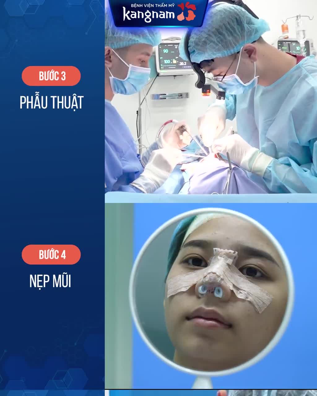 Mũi thấp, bè, hếch, lệch vẹo,...