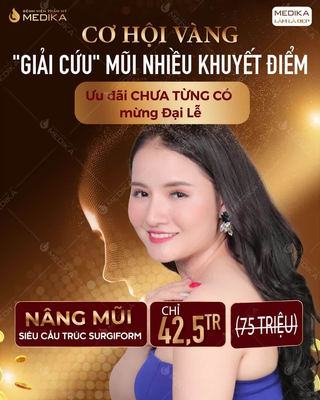 MŨI THẤP TẸT/ĐẦU MŨI NGẮN HẾCH/LỆCH GỒ KHÔNG CÒN LÀ NỖI BẬN TÂM