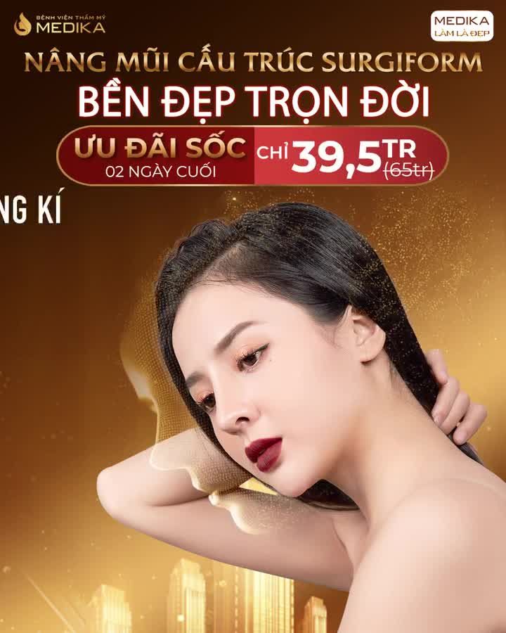 NÂNG MŨI CẤU TRÚC SURGIFORM - ĐƠN GIẢN MÀ ĐẸP