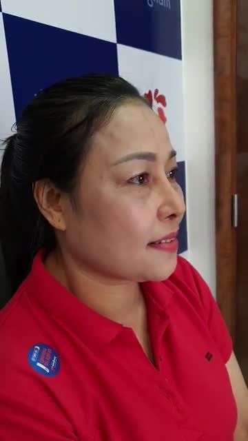 Nâng mũi đã thay đổi ngoạn mục gương mặt của khách hàng như thế nào? Cùng xem kết quả nâng mũi sline 4d nhé