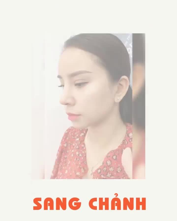 NÂNG MŨI - kiến tạo những NỮ THẦN THANH XUÂN