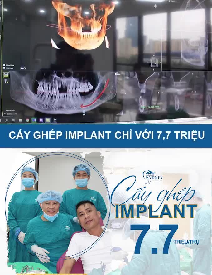 NÊN LÀM GÌ TRƯỚC KHI CẤY IMPLANT