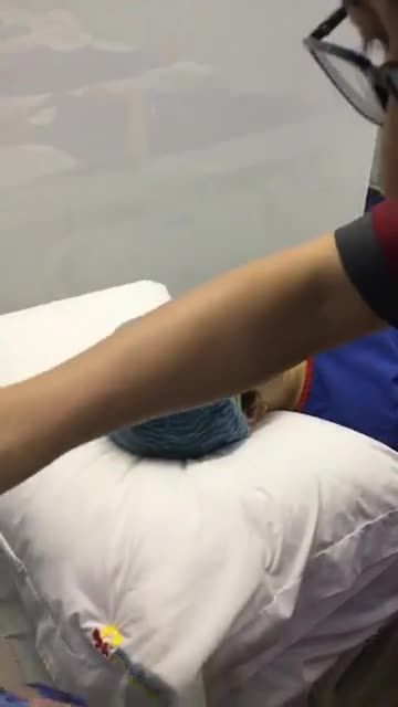 Nẹp mũi - Quy trình vô cùng quan trọng khi nâng mũi