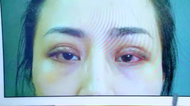 Nếu bạn đang gặp phải tình trạng mí lỗi, hỏng thì không nên bỏ qua video này!