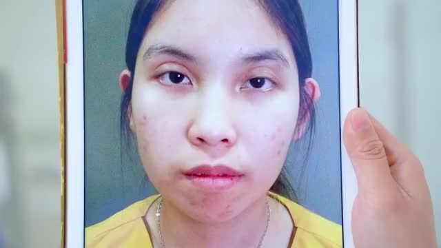 "Nếu không sửa lại ở Dr.Hải Lê thì con không biết sửa mí ở đâu, chỗ nào người ta cũng từ chối con".