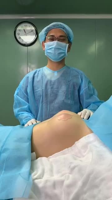 NGỰC PHẲNG, XA CÁCH hóa GÒ BỒNG NÓNG BỎNG, HÚT MẮT ngay sau phẫu thuật