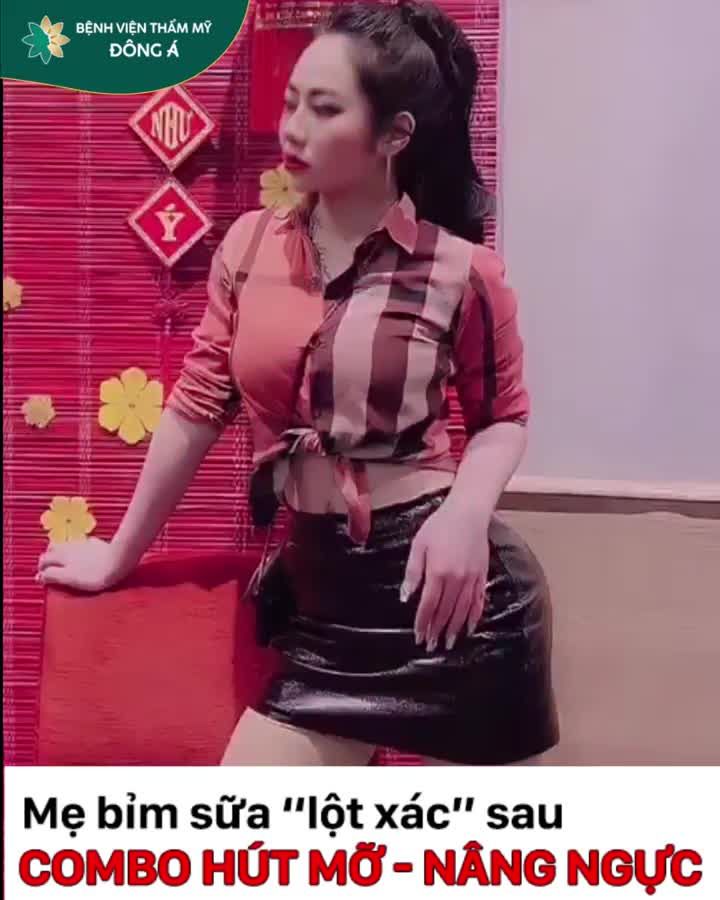 NGỰC SA TRỄ - BỤNG NGẤN MỠ là ác mộng của 98% bà mẹ SAU SINH