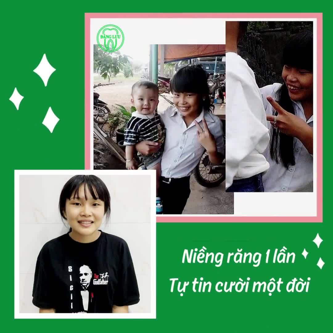Nha Khoa Đăng Lưu – Niềng răng 6 tiêu chuẩn vàng