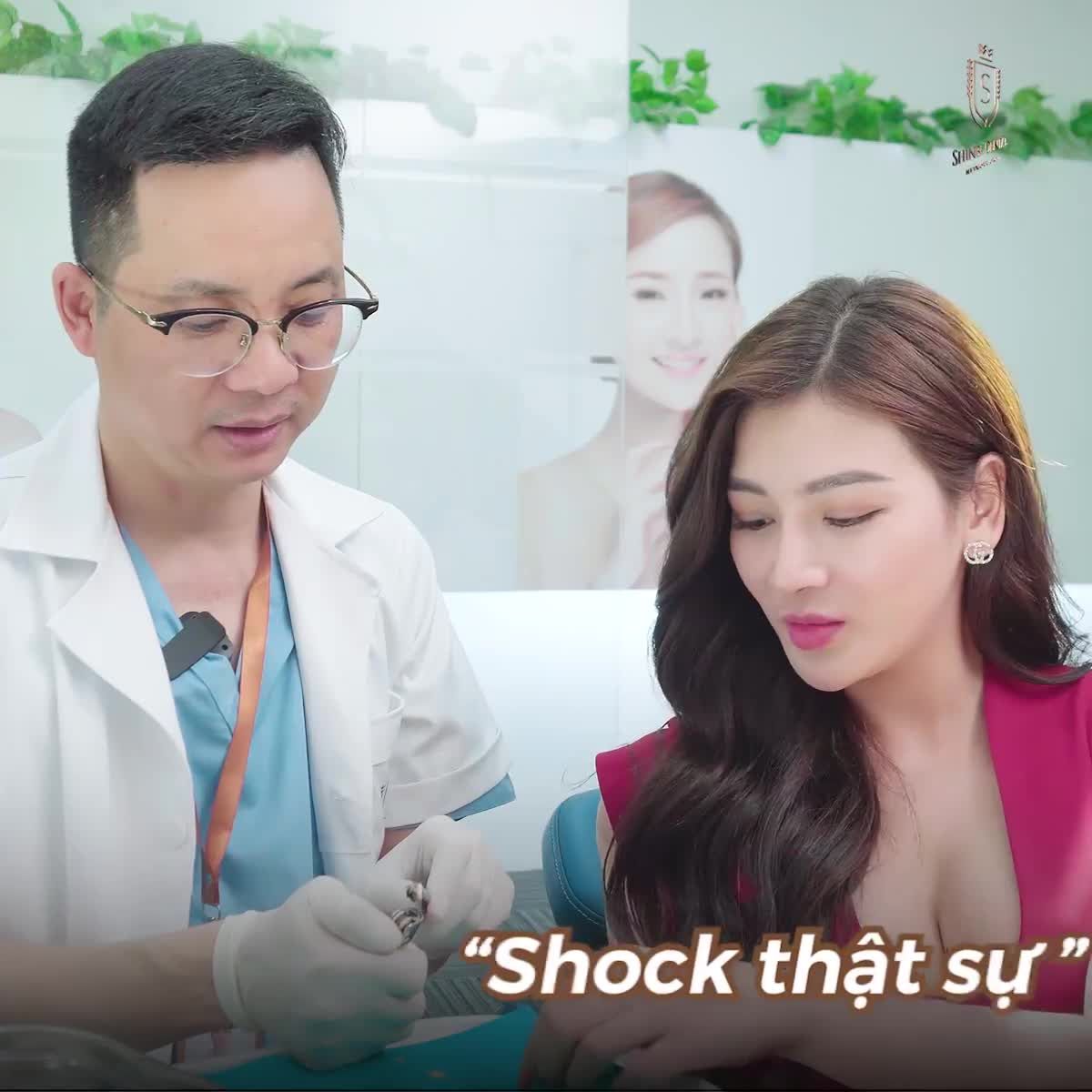 NHỰA COMPOSITE ĐỘI LỐT RĂNG SỨ?