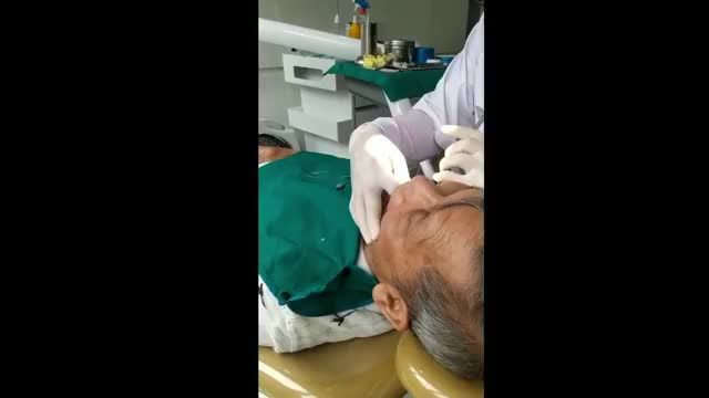 NHỮNG BƯỚC CUỐI CÙNG HOÀN THIỆN CA CẮM IMPLANT]