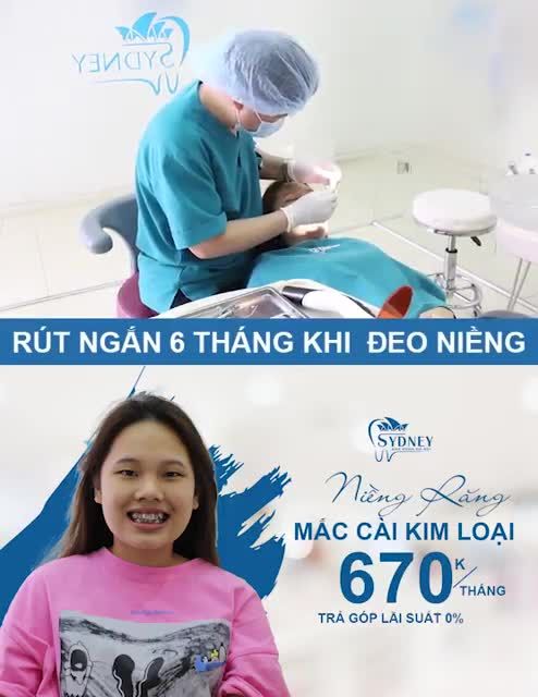 NIỀNG RĂNG MẮC CÀI KIM LOẠI