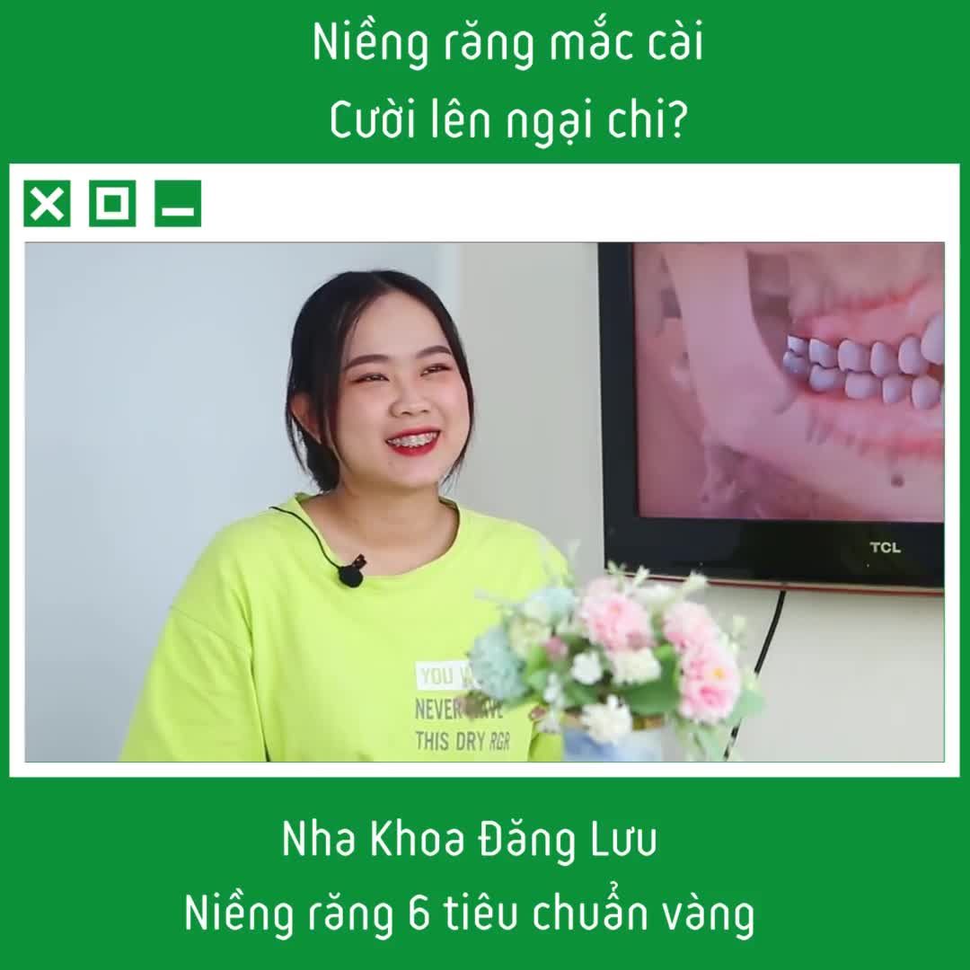 Niềng răng mắc cài những nụ cười ngộ nghĩnh