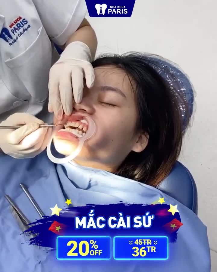 NIỀNG RĂNG SALE SỐC THÁNG 4 ĐẠI LỄ