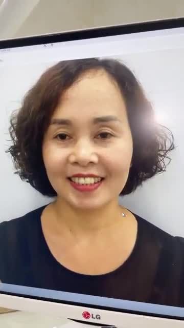 NỤ CƯỜI TỈ LỆ VÀNG SẴN SÀNG TỎA SÁNG SAU THẨM MỸ 22 RĂNG SỨ CERCON