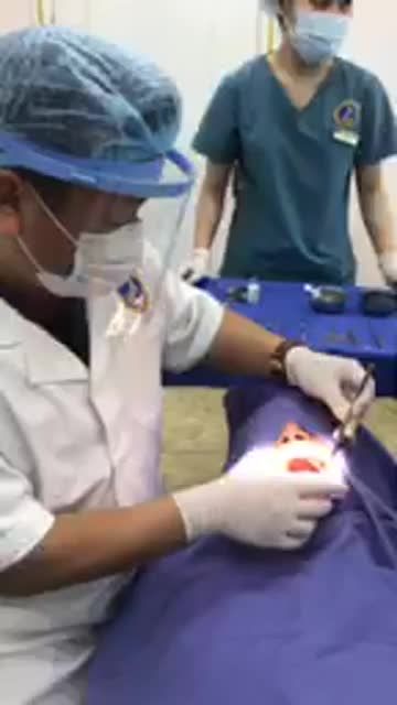 PHẪU THUẬT CẤY GHÉP IMPLAN TẠI NHA KHOA QUỐC TẾ VIỆT ĐỨC
