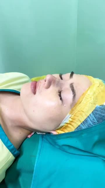 Phom mũi Cấu trúc đẹp xuất sắc