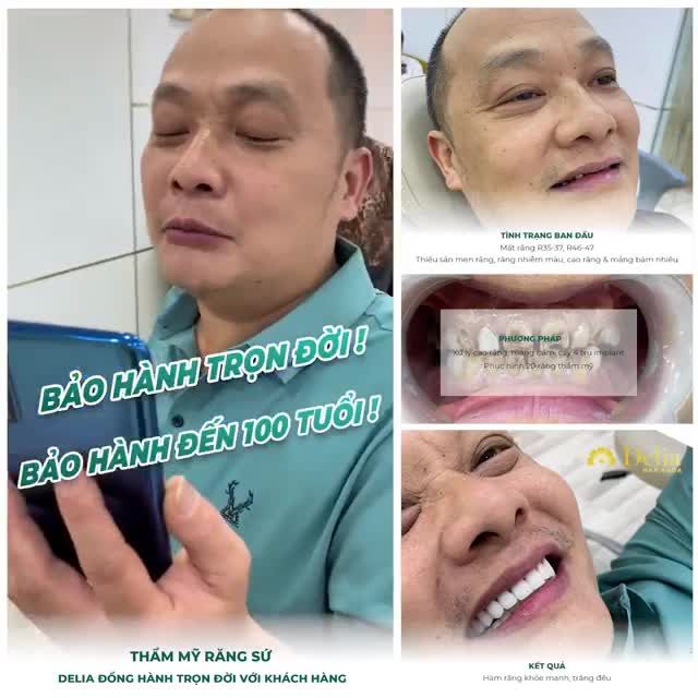 PHỤ NỮ QUAN TÂM ĐIỀU GÌ NẾU CHỒNG ĐI TRỒNG RĂNG VÀ LÀM RĂNG SỨ?