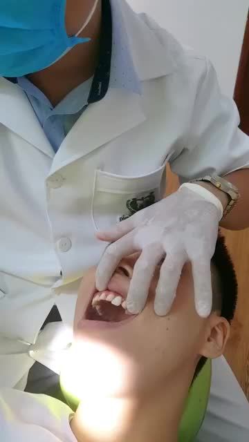 PHỤC HÌNH THẨM MỸ 20 RĂNG SỨ CHO MỘT CASE KHÁCH HÀNG NAM