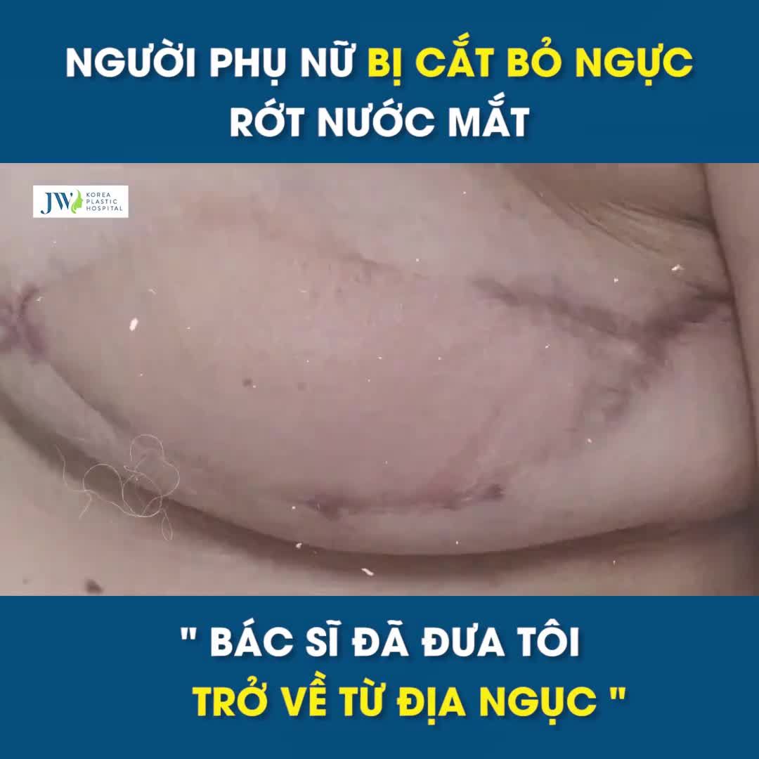 Sau 8 năm bị CẮT TUYẾN VÚ, bệnh nhân KHÓC NẤC HẠNH PHÚC trước kết quả 5 giờ TÁI TẠO NGỰC