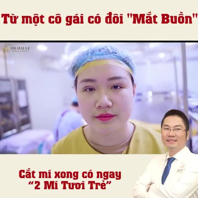 Sẽ không phí 2 phút của chị em khi cảm nhận sự khác biệt của phương pháp cắt mí MK khắc phục: Mắt buồn, mắt 1 mí, nhiều da chùng và mỡ thừa,... !