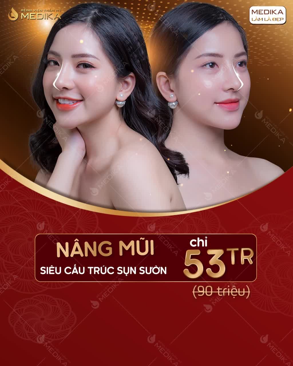 SỞ HỮU DÁNG MŨI HOÀN HẢO - GÓC NGHIÊNG THẦN THÁNH - ĐẸP BỀN VỮNG VỚI GIÁ SIÊU HẤP DẪN