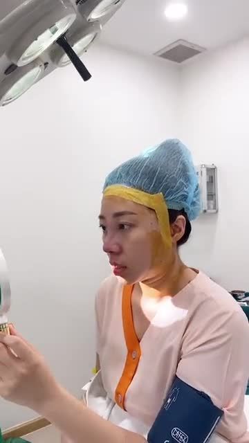 TÁI CẤU TRÚC CHO MŨI TỪNG TIÊM FILLER