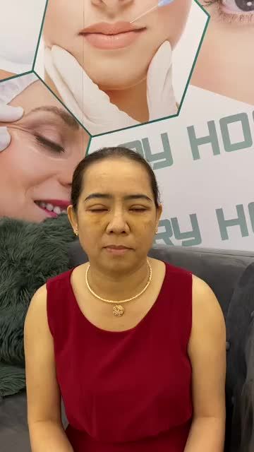 TẠI SẢNH BỆNH VIỆN KHÁCH HÀNG CHIA SẺ CẢM NHẬN SAU KHI QUAY LẠI CẮT CHỈ MẮT