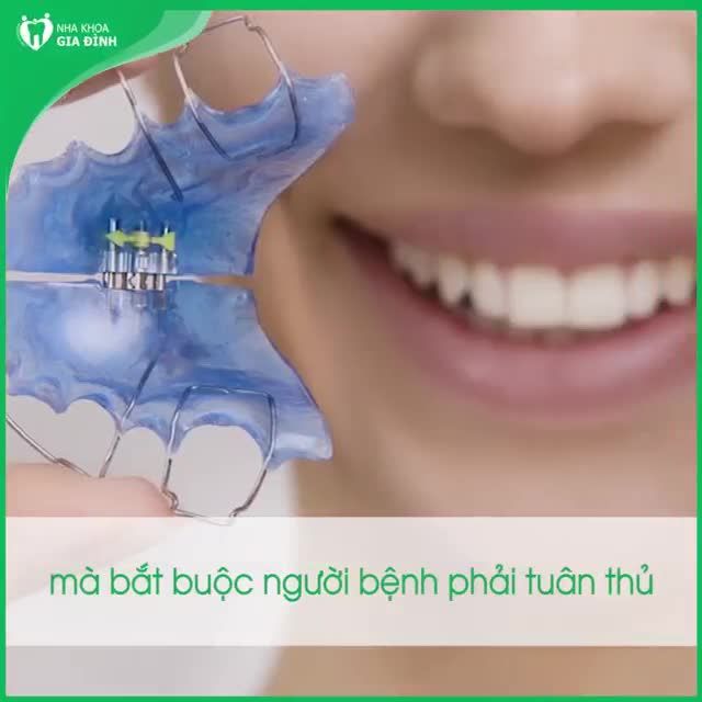 TẠI SAO BẮT BUỘC PHẢI ĐEO HÀM DUY TRÌ SAU KHI NIỀNG RĂNG