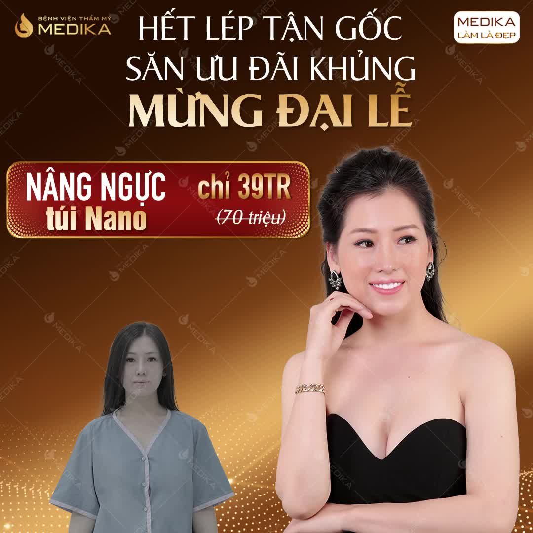 THOÁT KIẾP "HAI LƯNG" CÙNG NÂNG VÒNG 1 TÚI NANO