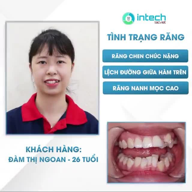 TRÁI NGỌT TRÊN HÀNH TRÌNH THAY ĐỔI SAU NIỀNG RĂNG