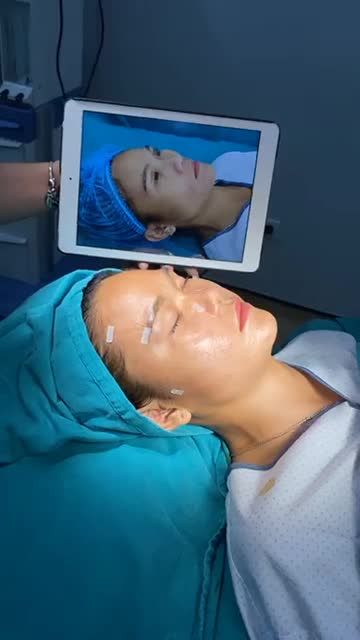 TRẺ RA 10 TUỔI SAU 1 BUỔI CẤY MỠ TỰ THÂN