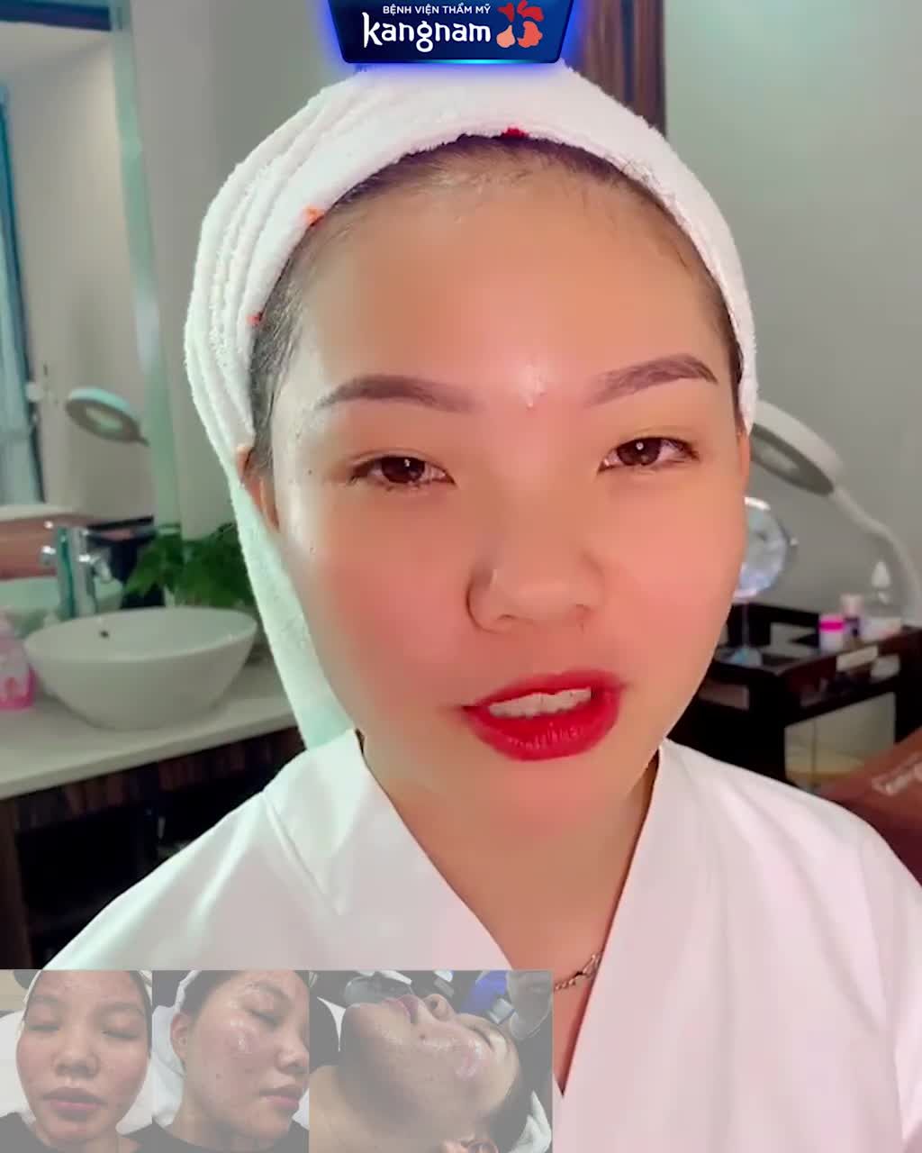 Trị mụn chuẩn chuyên gia bằng CÔNG NGHỆ CAO