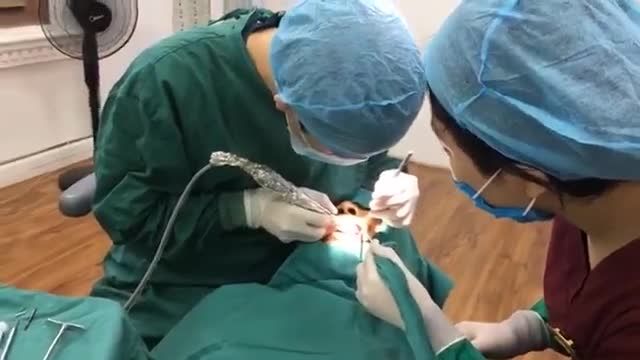 Trồng implant răng số 25 cho anh Sơn