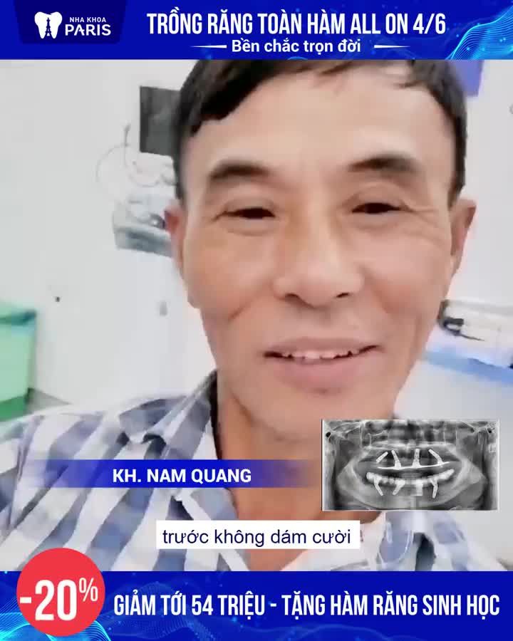 TRỒNG RĂNG TOÀN HÀM - TẶNG HÀM 1000$