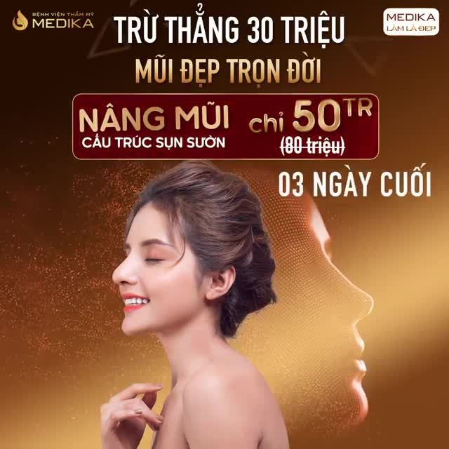 TỰ TI NHIỀU NĂM VÌ MŨI THẤP NGẮN VÀ CÁI KẾT