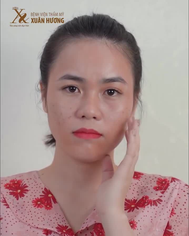 Tự tin khoe da mộc với gói CHĂM SÓC DA CHUYÊN SÂU tại Bệnh Viện Thẩm Mỹ Xuân Hương.