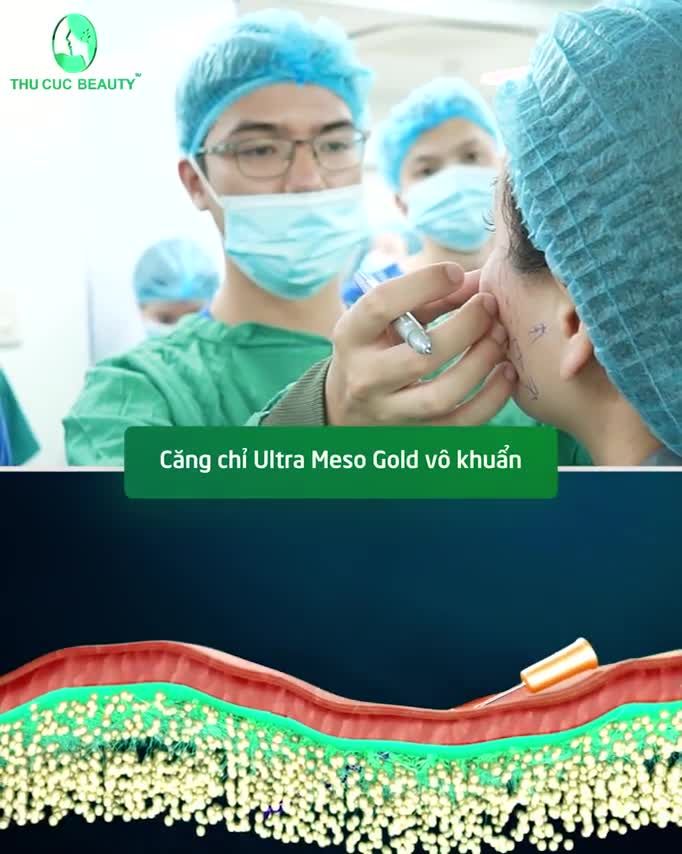 U50 bỗng chốc "hóa" U40 chỉ sau 01 liệu trình Căng chỉ Ultra Meso Gold vô khuẩn
