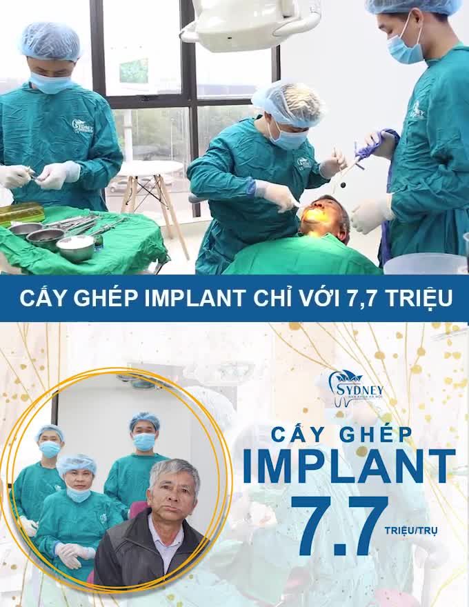 ƯU ĐIỂM CỦA KỸ THUẬT CẤY GHÉP IMPLANT