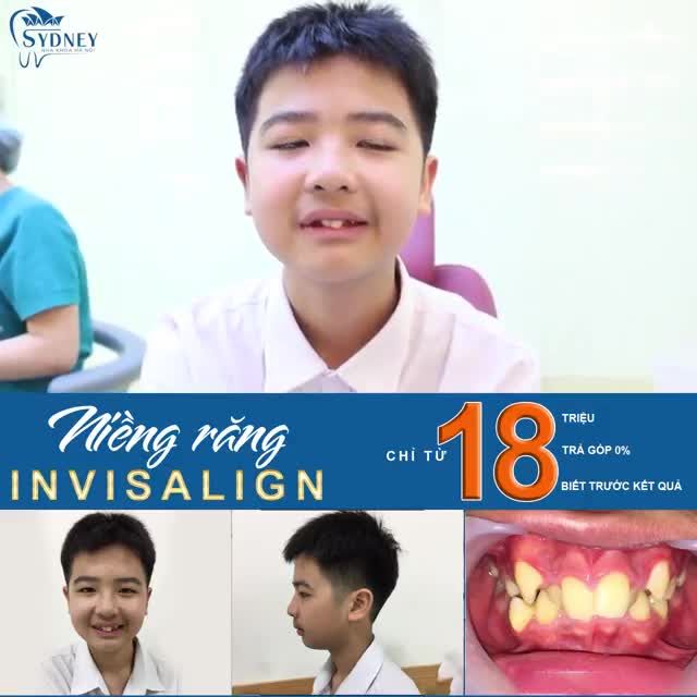 ƯU ĐIỂM VƯỢT TRỘI CỦA INVISALIGN