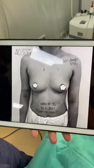 VÒNG 1 CĂNG ĐẦY - NHÌN LÀ NGẤT NGÂY