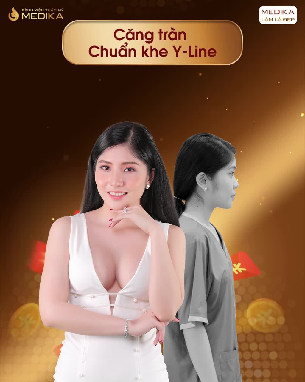 VÒNG 1 ĐẸP MỸ MÃN - HẾT MẶC CẢM TỰ TI