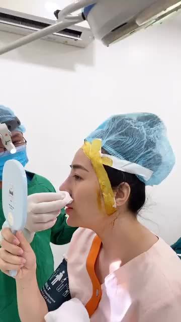 XEM DÁNG MŨI TRƯỚC KHI ĐÓNG VẾT KHÂU