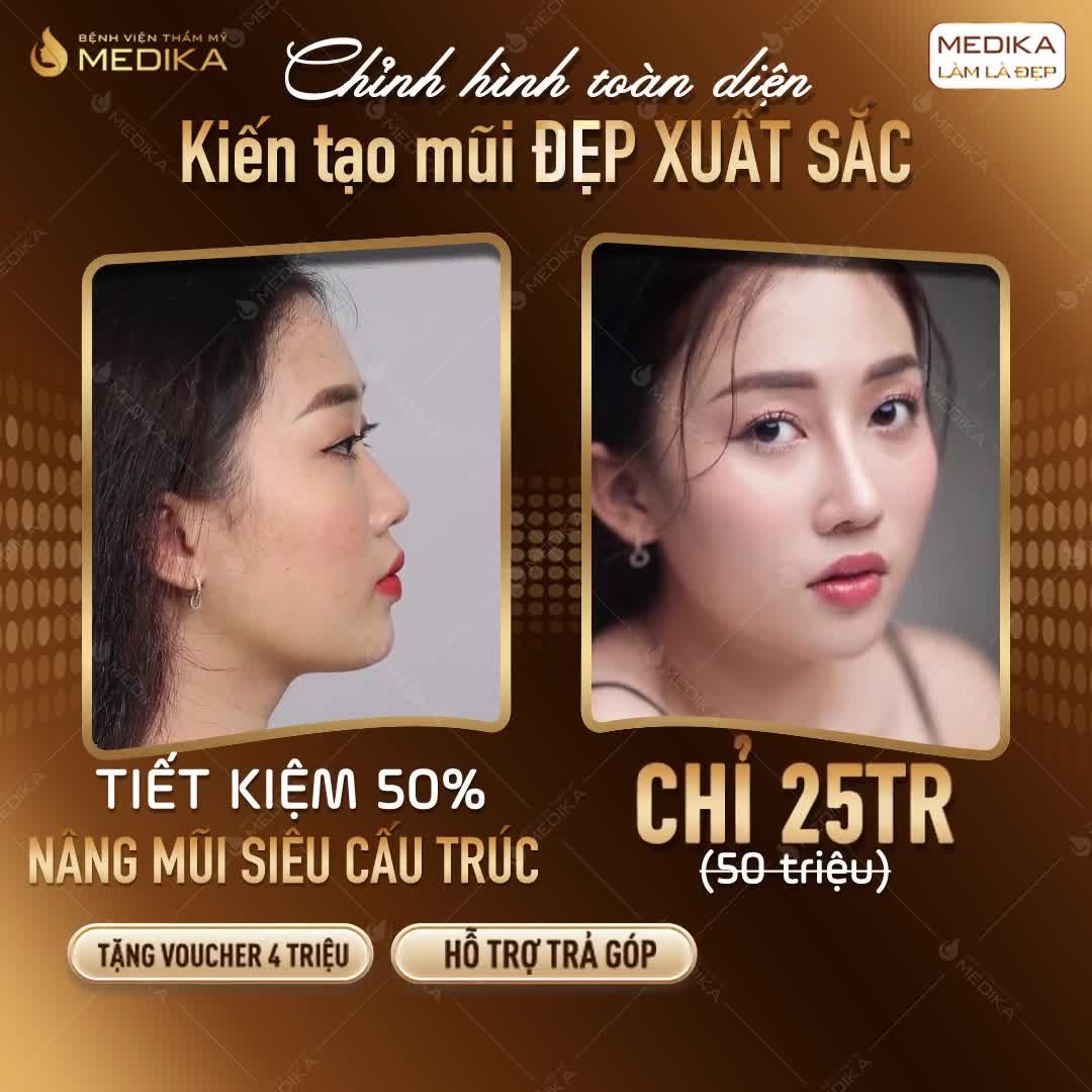 XÓA SỔ MŨI THẤP TẸT - "LỘT XÁC" THÀNH HOTGIRL