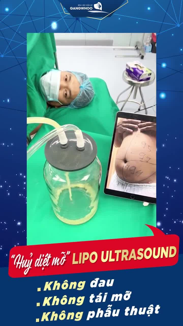 XUA TAN BỤNG BIA – XOÁ TAN MUỘN PHIỀN